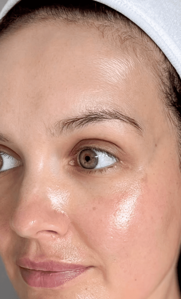 Vitaminc C peel, IG @skincarebyjoanne | Treatwell