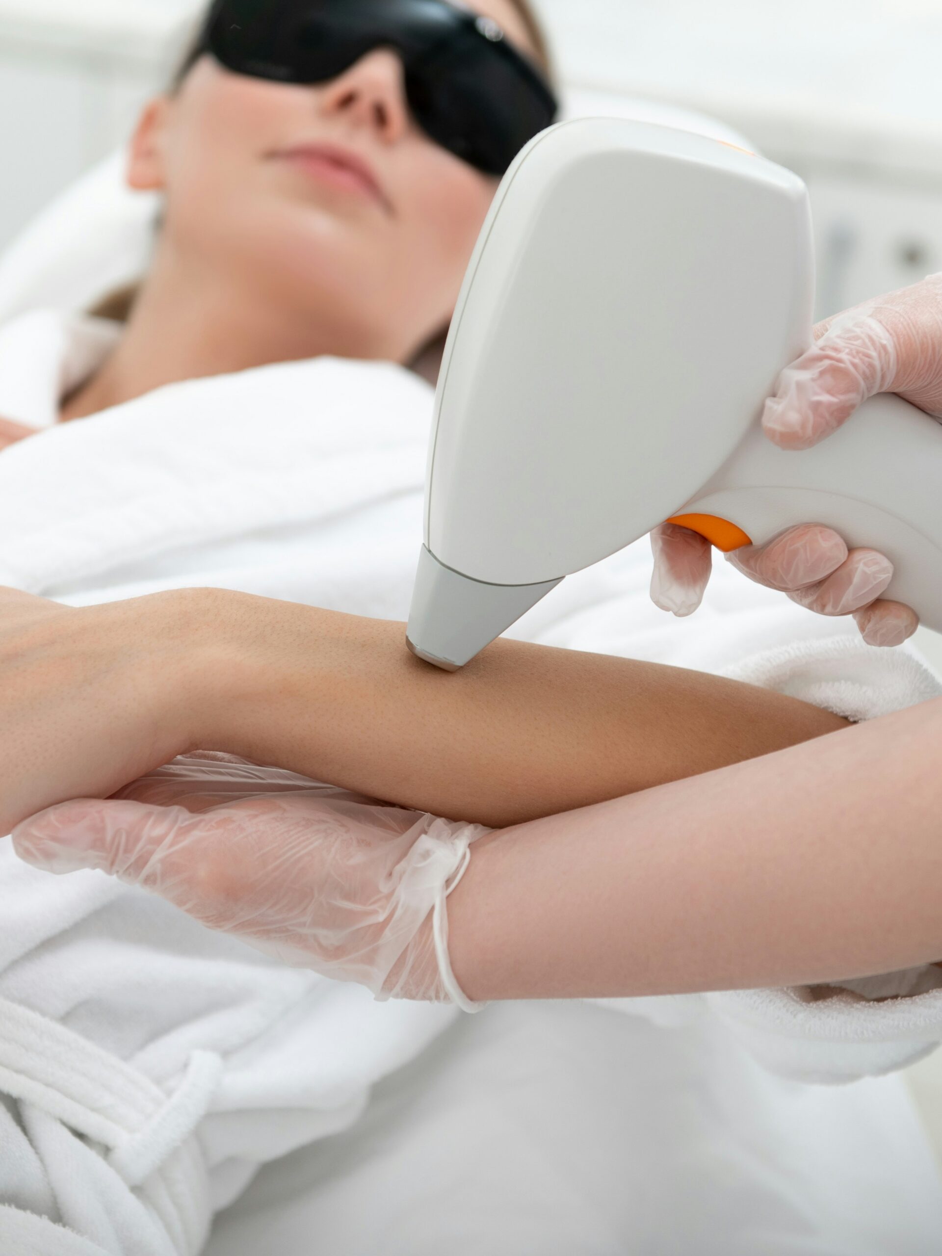 Woman receiving IPL treatment on her arm in clinic
