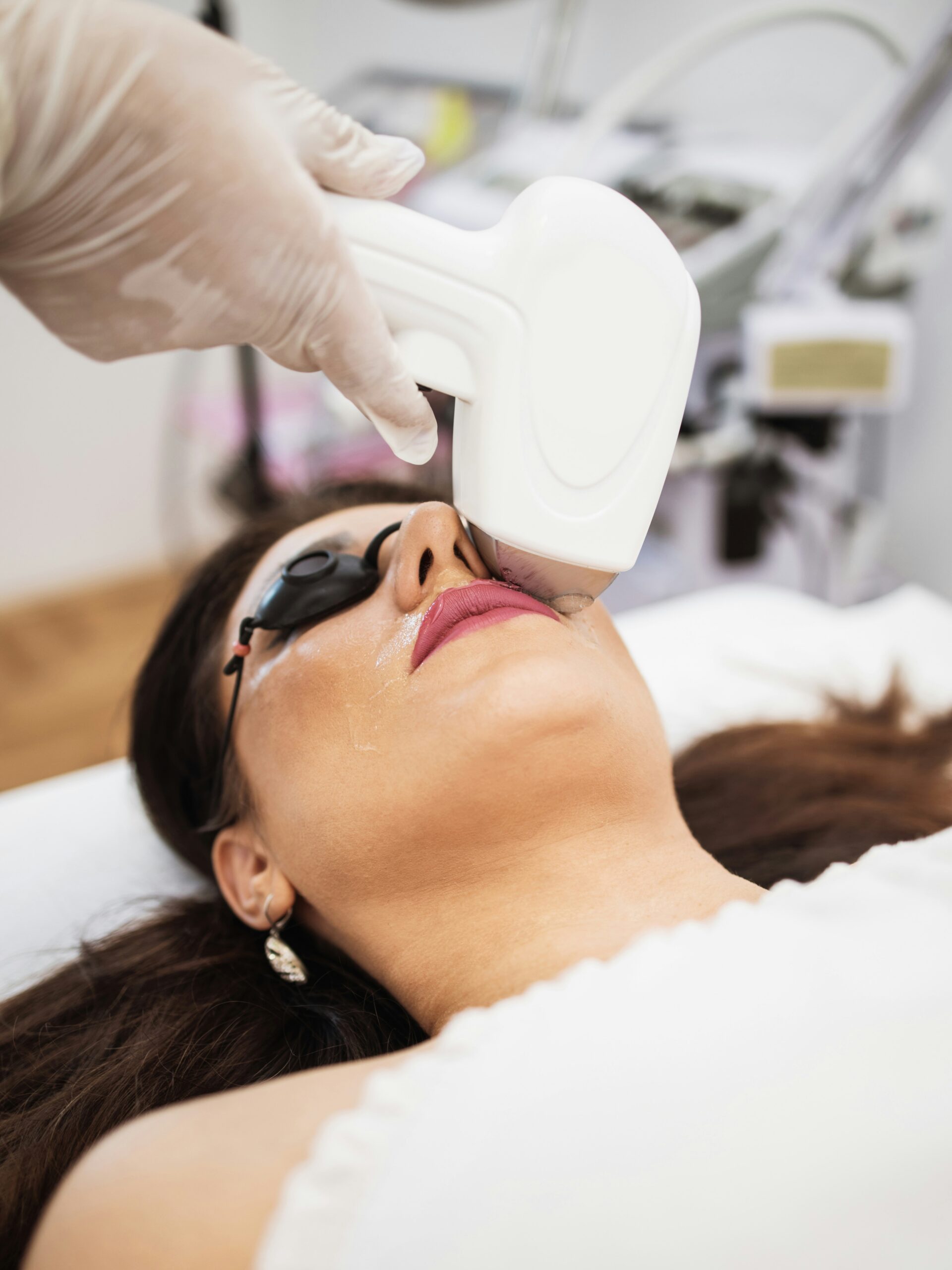 Woman receiving IPL treatment on her upper lip in clinic
