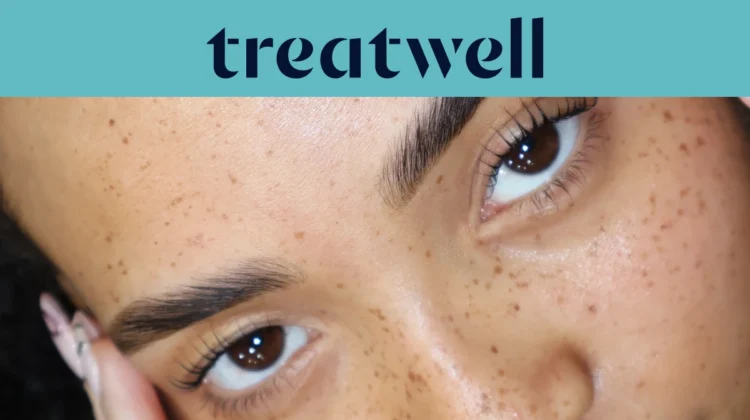 Treatwell teal banner with close-up of naturally lifted lashes after a Korean lash lift on freckled skin