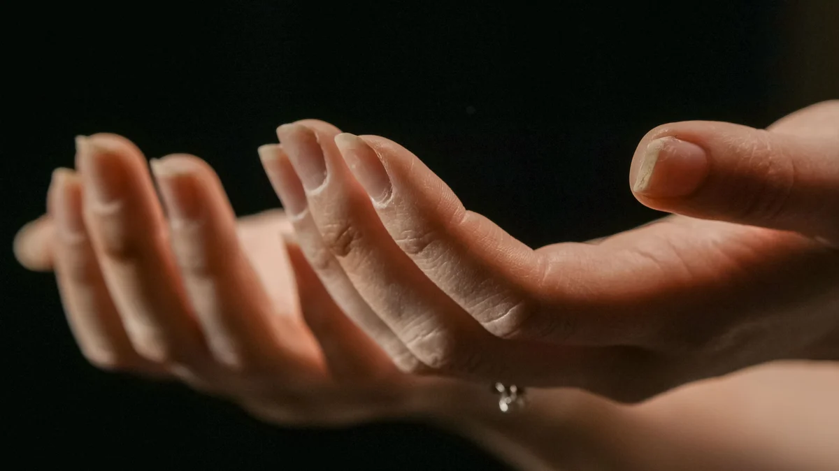 Two hands outstretched with palms up showing flaking nails